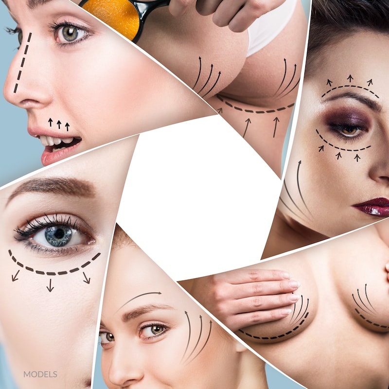 plastic surgery trends