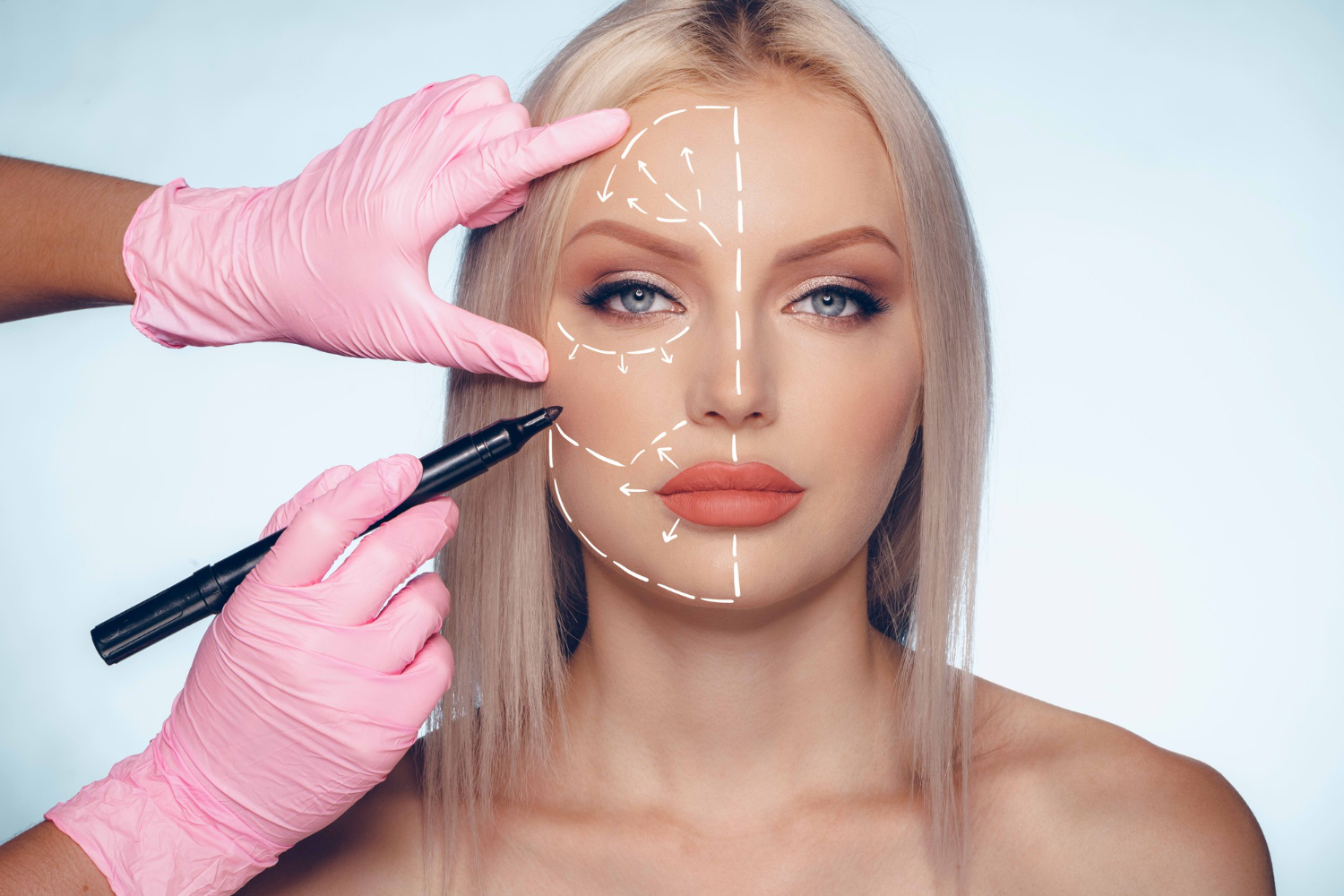 Non Surgical Face Lifts in Miami